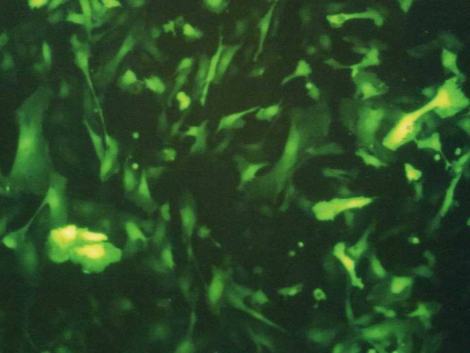 NEPA21 / ddy Mouse Endometrial Cells - Transfection Efficiency 80 per cent
